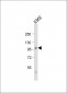 SRPK1 Antibody (N-term)